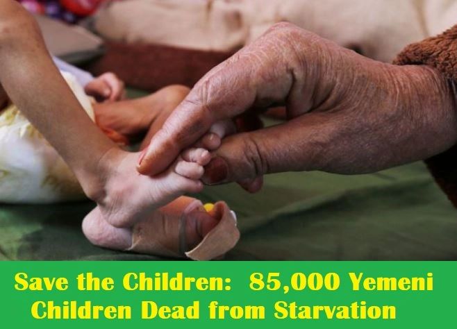 Children Starved